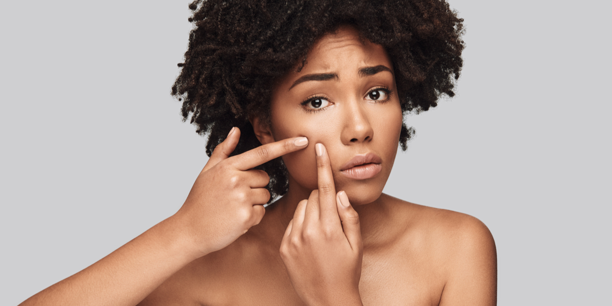 how-to-naturally-get-rid-of-acne-cbd-advisors